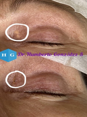 Foto Gonz�lezEst�ticaFacial (Centro Est�tico 2020)